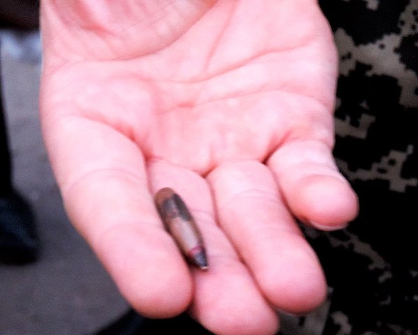 На фото – куля, випущена з кулемета Калашникова, калібру 7,45, що застрягла у Геннадія в стегні