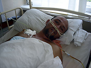 Олександр Куча тривалий час перебував на лікуванні. На пам'ять у нього в тілі залишається куля, яку лікарі не виймають через загрозу параліча
