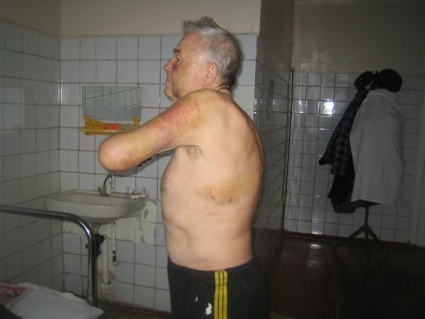 Ось так виглядає Володимир Воскобойник навіть після двох тижнів лікування