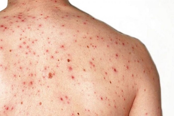 11e67dc685a6aa79b797f1c633bffadd_xl