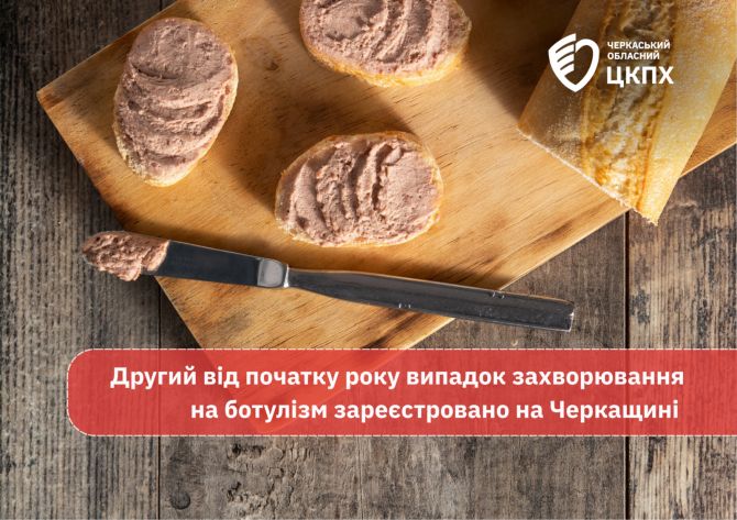 YAkshho-vy-ne-pomylyayetesya-znachyt-vy-robyte-zanadto-dribni-pomylky-70-1600x1131