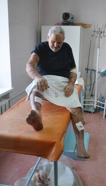 Володимир Варивода більше місяця ще буде у лікарні 