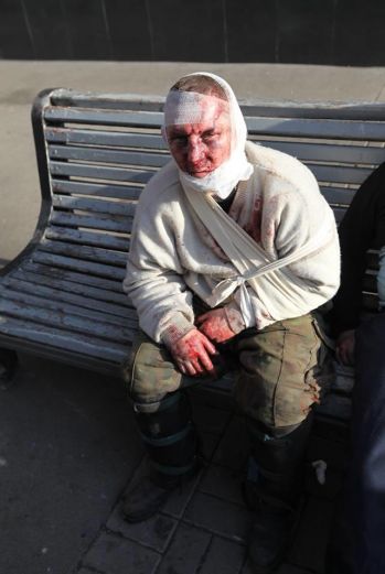 Фото постраждалого активіста з Майдану